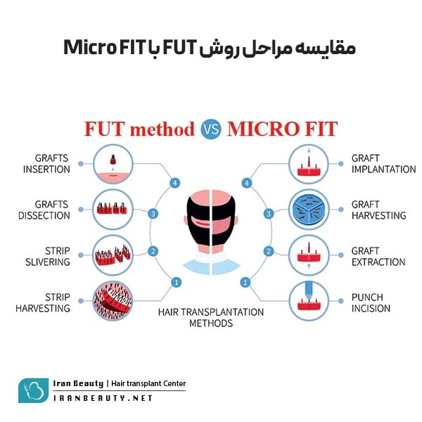 مقایسه روش Micro fit