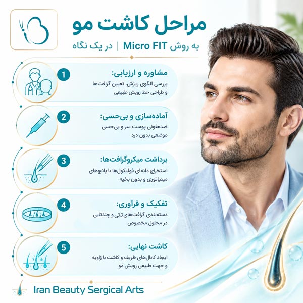 مراحل کاشت مو به روش Micro FIT