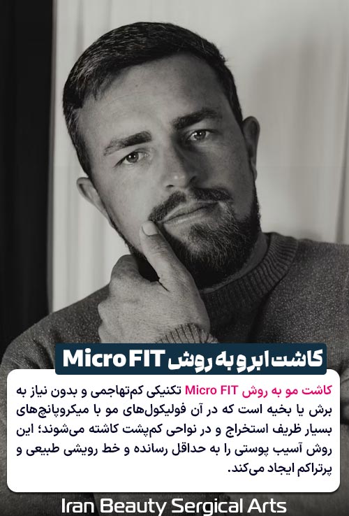 کاشت مو به روش Micro FIT