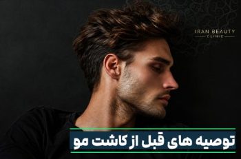 توصیه های قبل از کاشت مو