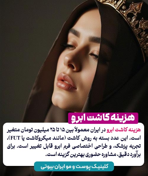 هزینه کاشت ابرو چقدر است ؟