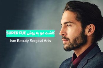 کاشت مو به روش SUPER FUE