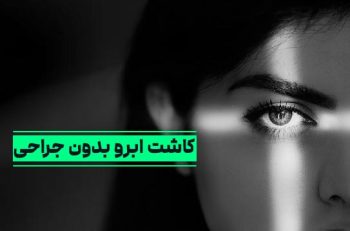 کاشت ابرو بدون جراحی