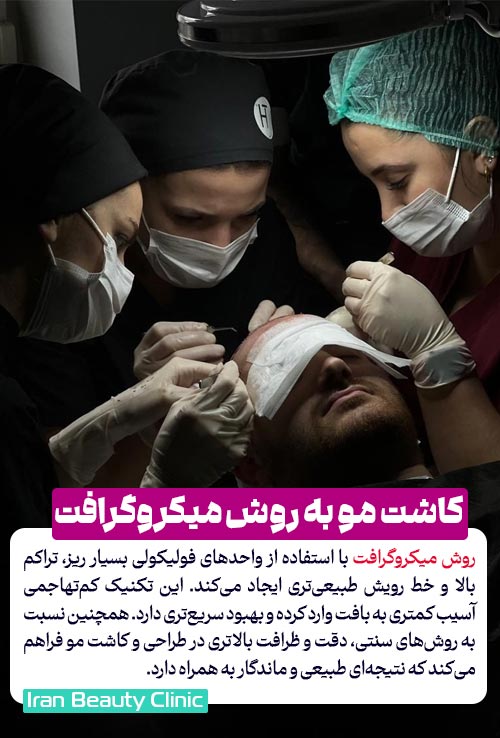 کاشت مو به روش میکروگرافت چیست