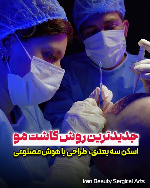 کاشت موی جدید با هوش مصنوعی