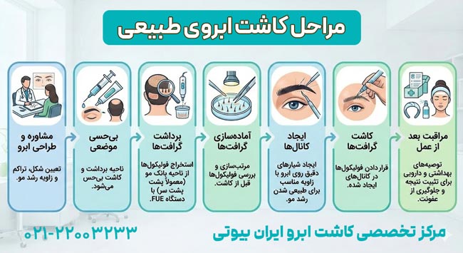 مراحل کاشت ابروی طبیعی