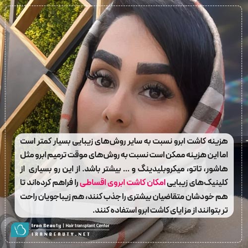 هزینه کاشت ابروی اقساطی