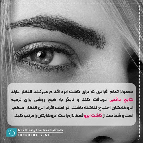 کاشت ابروی دائمی