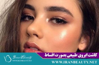 کاشت ابروی اقساطی