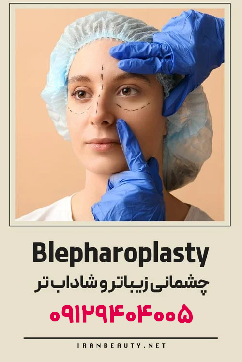 بلفاروپلاستی کلینیک ایران بیوتی