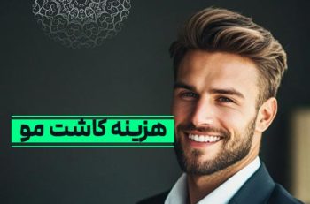 هزینه کاشت مو به همراه تصویر مرد با موهای پرپشت