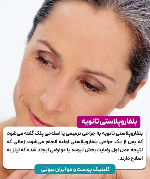 بلفاروپلاستی ثانویه