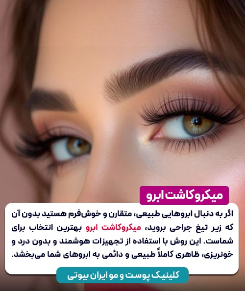 میکروکاشت ابرو