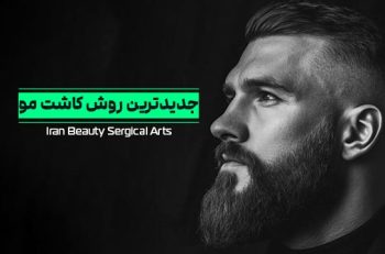 جدیدترین روش کاشت مو در ایران