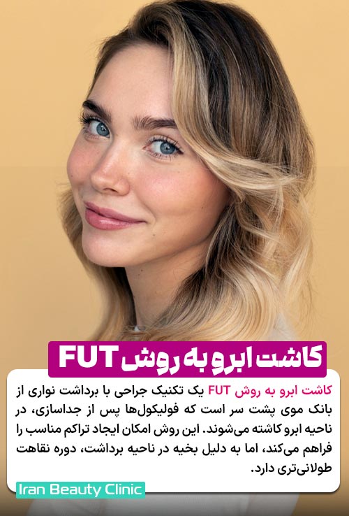 کاشت ابرو به روش FUT چیست