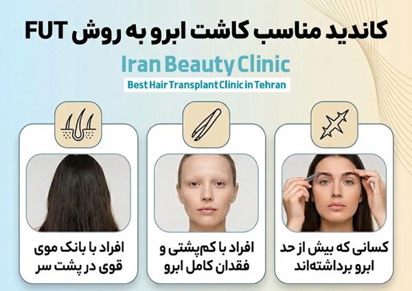 کاندید مناسب کاشت ابرو به روش FUT