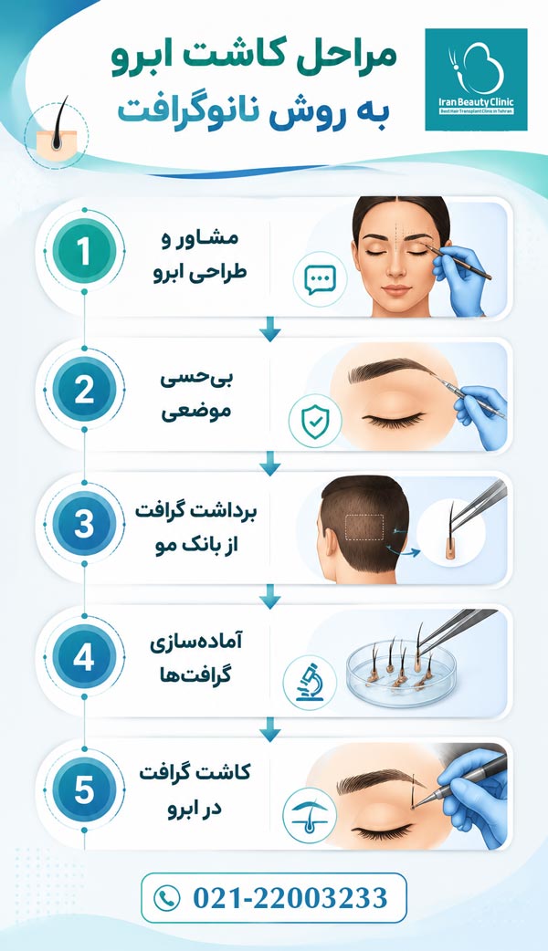 مراحل کاشت ابرو به روش نانوگرافت
