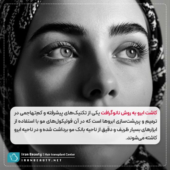 کاشت ابرو نانوگرافت چیست