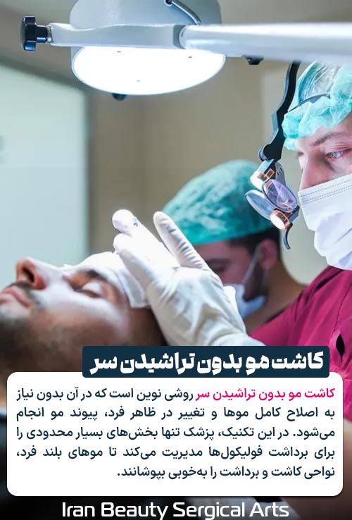کاشت مو بدون تراشیدن سر
