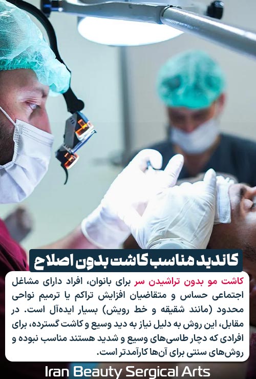 کاندید مناسب کاشت مو بدون اصلاح سر