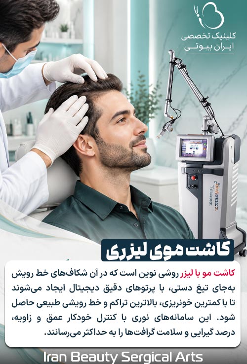 کاشت موی لیزری