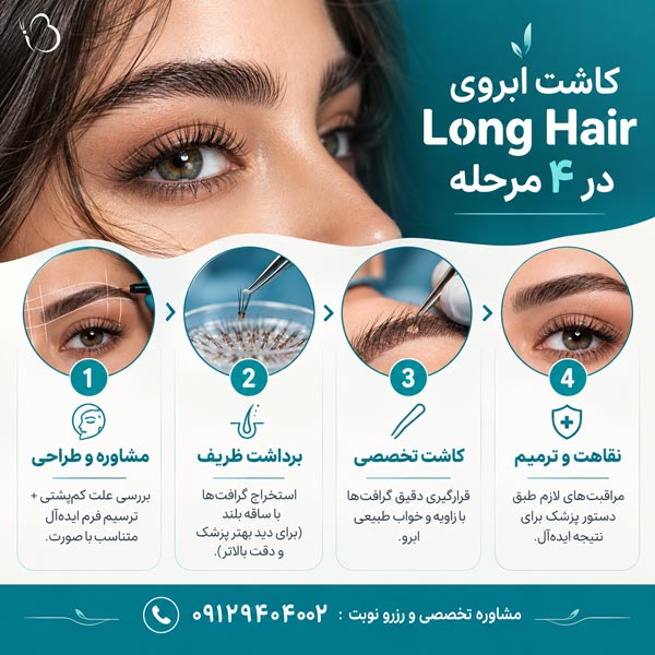 مراحل انجام کاشت ابروی بلند