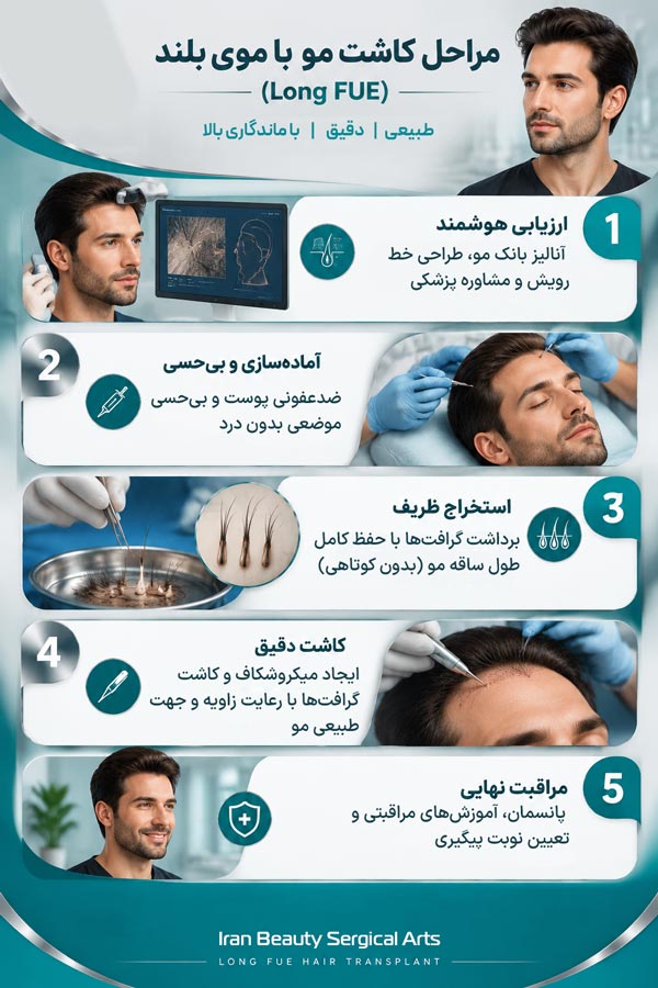 مراحل کاشت مو به روش FUE