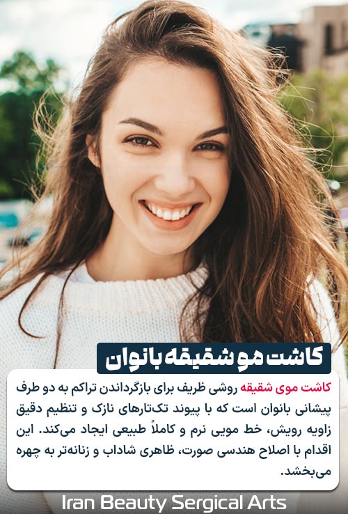 کاشت مو شقیقه خانم ها